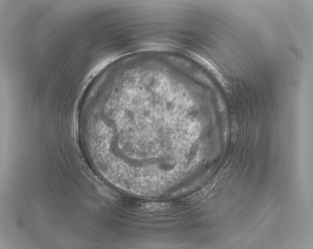 X0000115741419200912031418