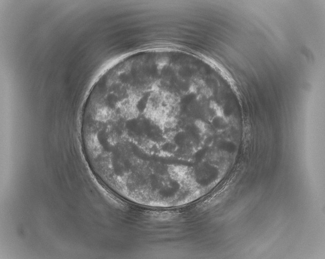 X0000115741429200912031418