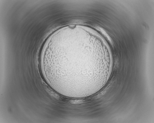 X0000115741435200912031418