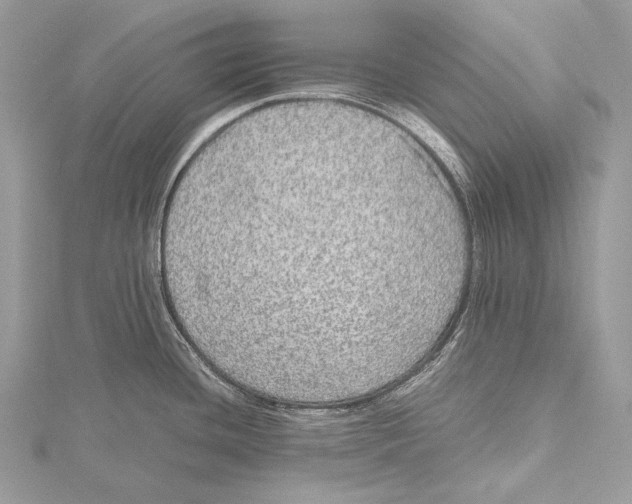 X0000115741436200912031418