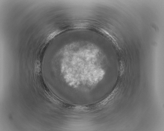 X0000115741449200912031417