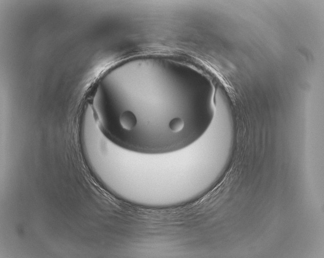 X0000115741455200912031417