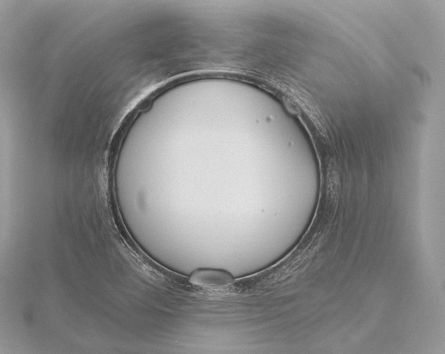 X0000115741460200912031417