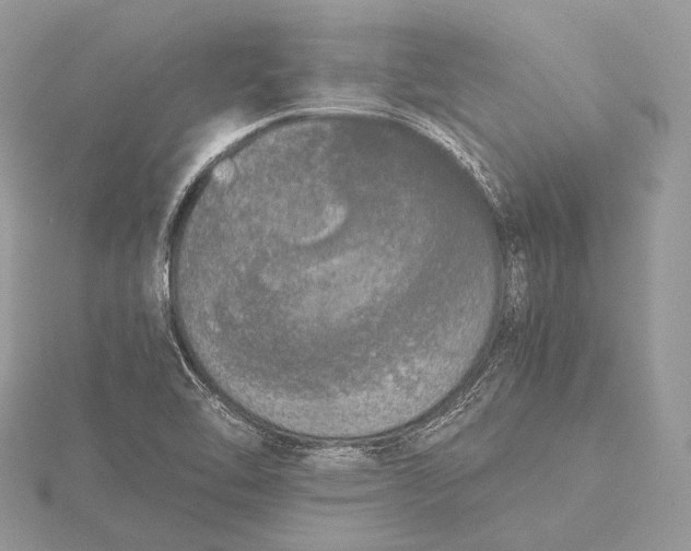 X0000115741462200912031417