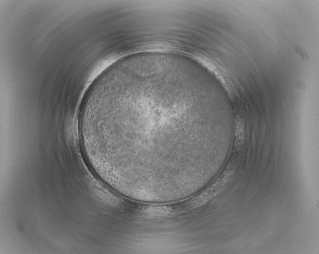 X0000115741466200912031417