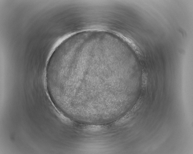 X0000115741470200912031417