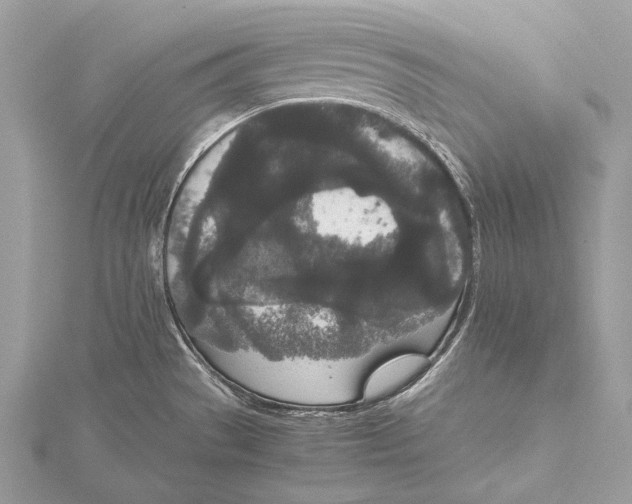 X0000115741529200912031417