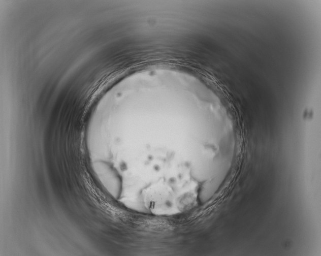 X0000115760146200911131007