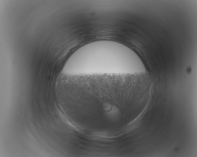 X0000115760171200911131007