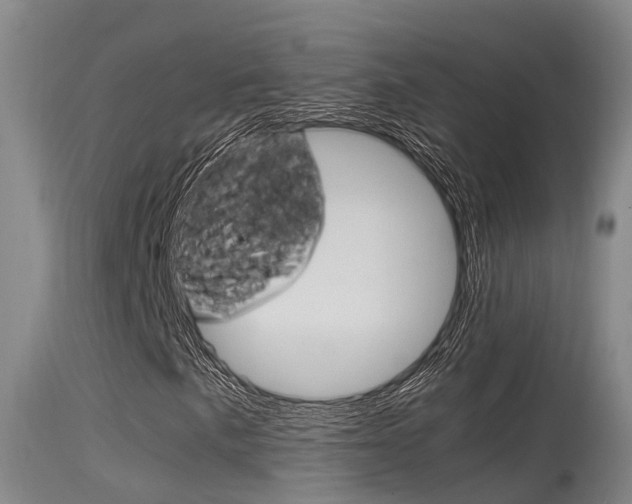 X0000115761057200911130954