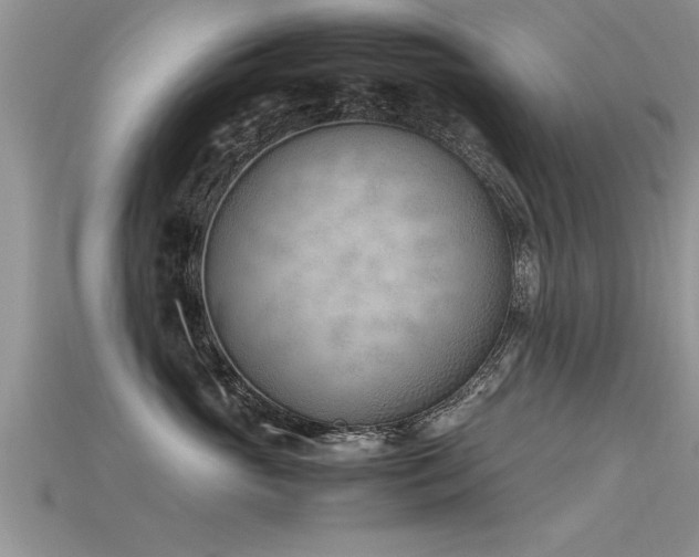 X0000115760765200911131156