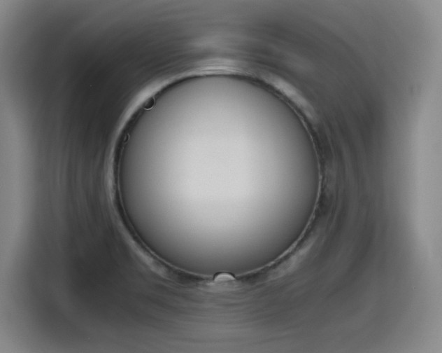 X0000115761469200911201148