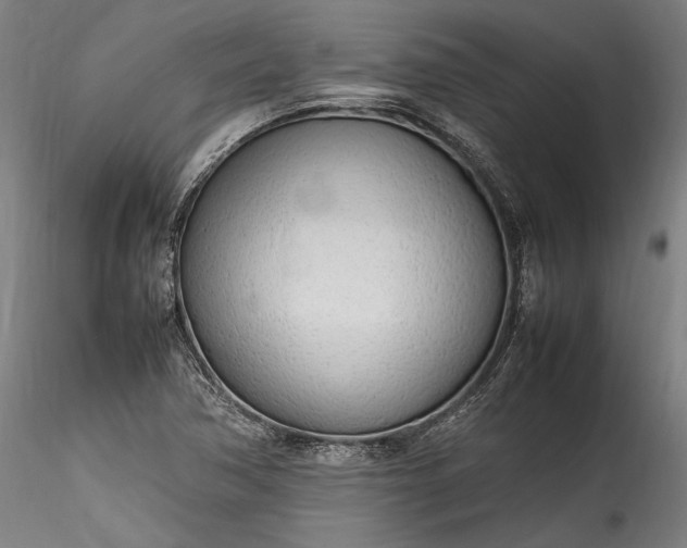 X0000115761362200911271107