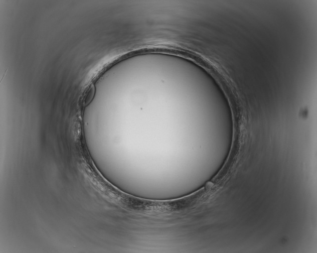 X0000115761363200911271107