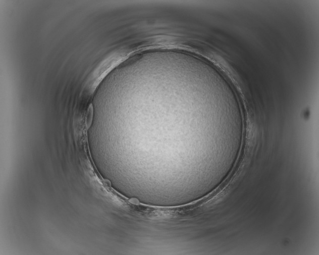 X0000115761385200911271106