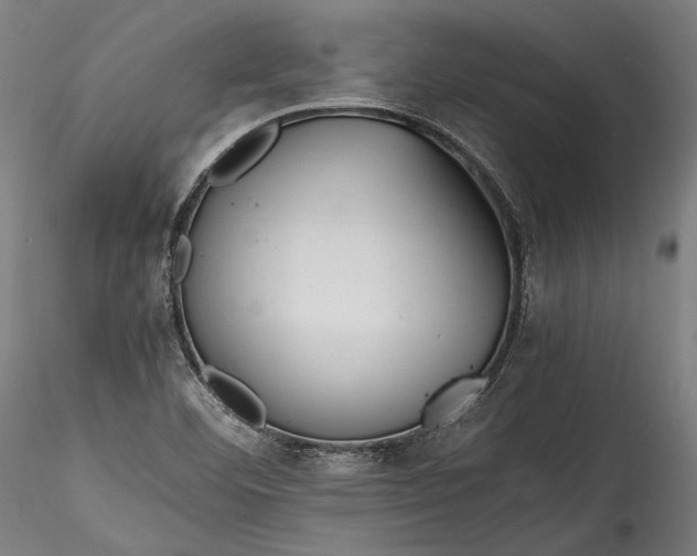 X0000115761460200911271105