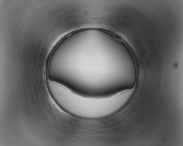 X0000115761468200911271105