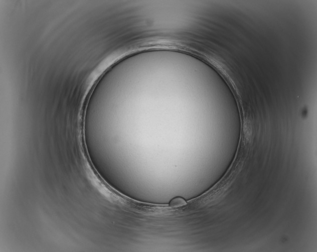 X0000115761482200911271105