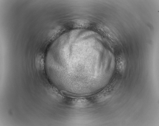 X0000115760716200912041410