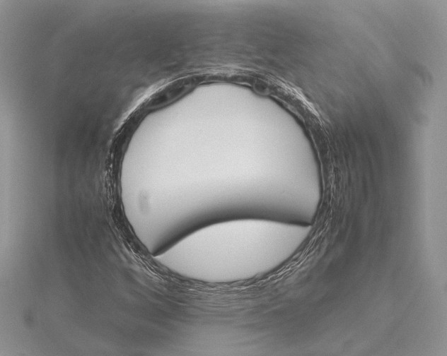 X0000115761256200912041403