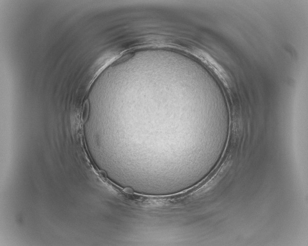 X0000115761385200912041401