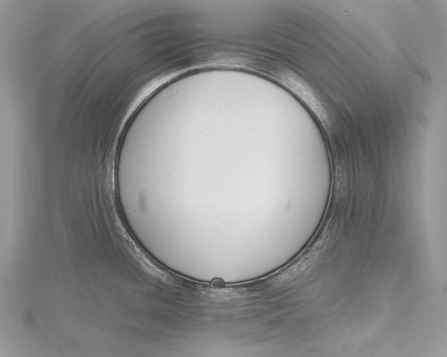 X0000115761436200912041401