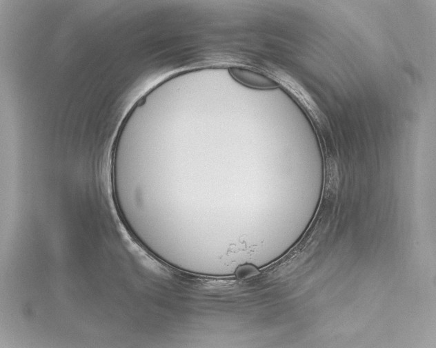 X0000115761439200912041401