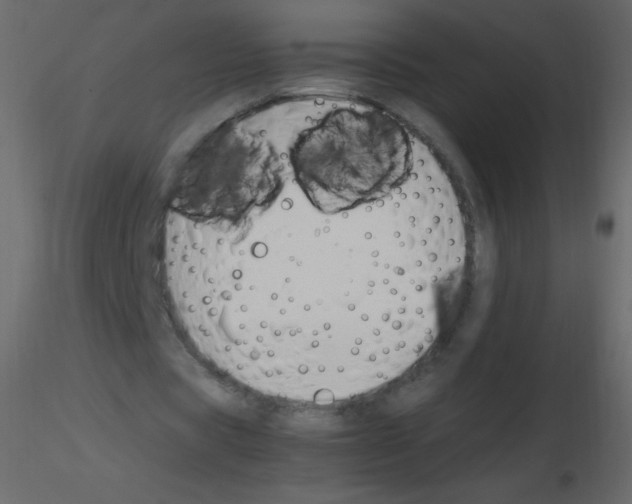 X0000115760529200912241731