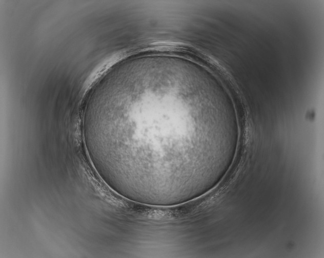 X0000115771362200911271130