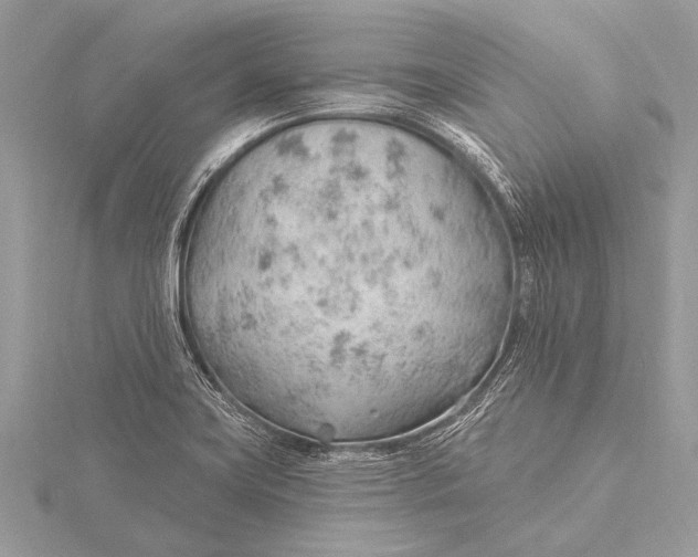 X0000115771419200912041422