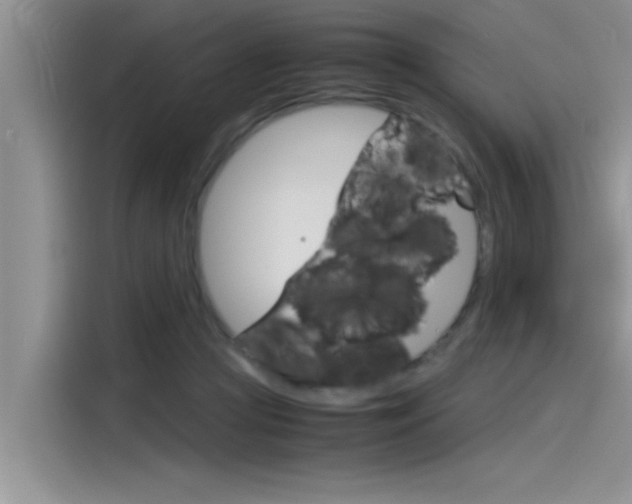 X0000115780361200911131011