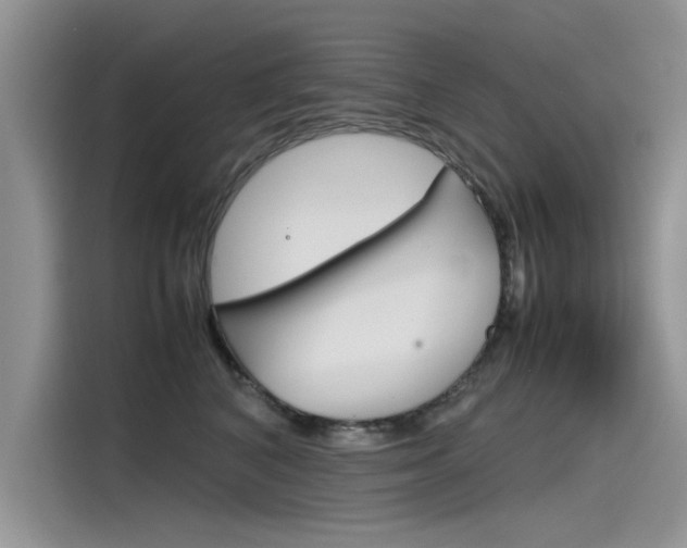 X0000115780616200911131007