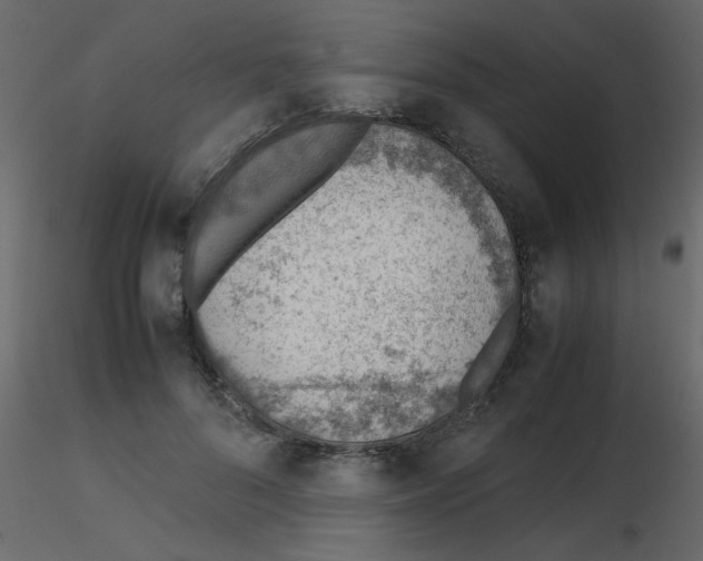 X0000115780696200912241811