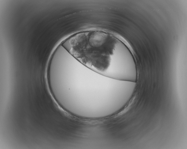 X0000115791149200911131021