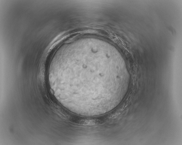 X0000115790295200912041518