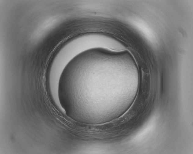 X0000115790387200912041517