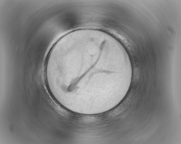 X0000115791470200912041502