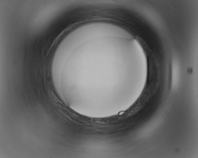 X0000115790387200912241836