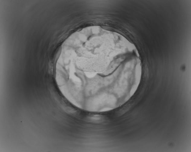 X0000115790467200912241835