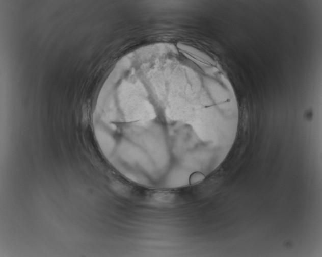 X0000115790471200912241835