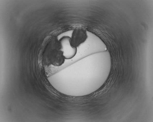 X0000115801106200911131016