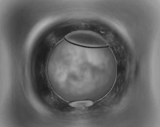 X0000115800195200911201405