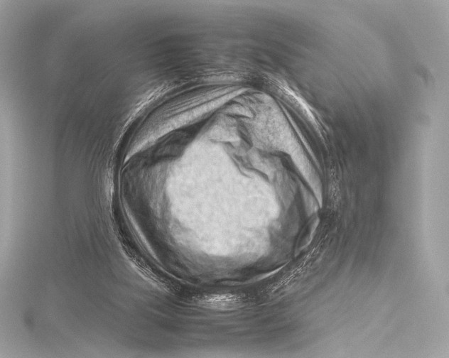 X0000115800059200912041542