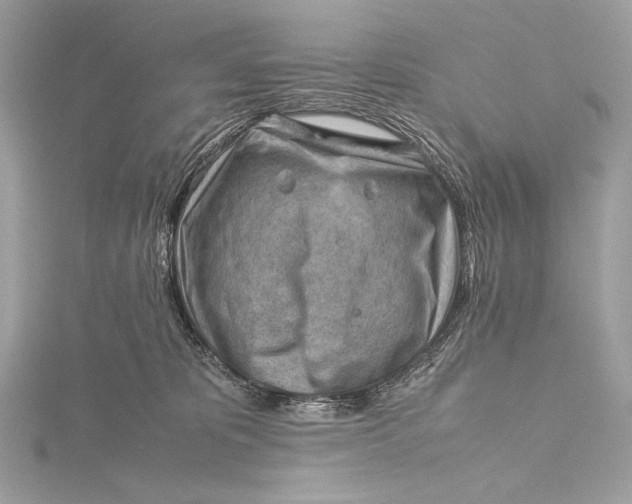 X0000115800325200912041539