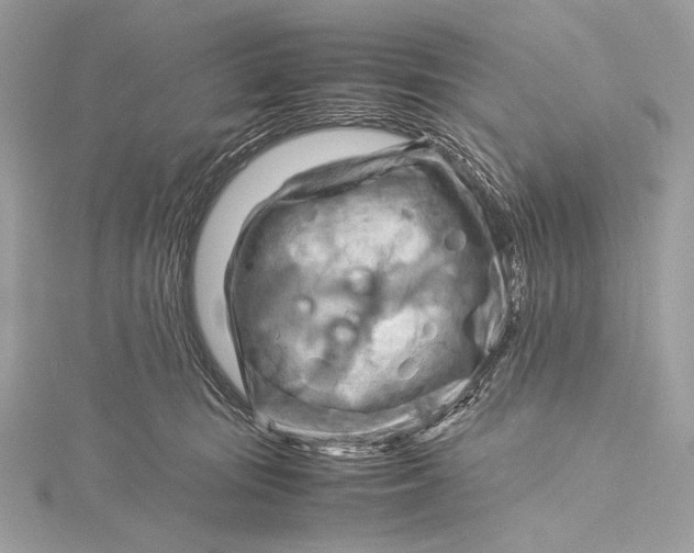 X0000115800371200912041538