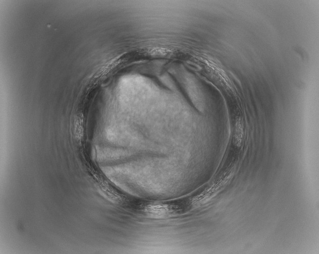 X0000115800413200912041537