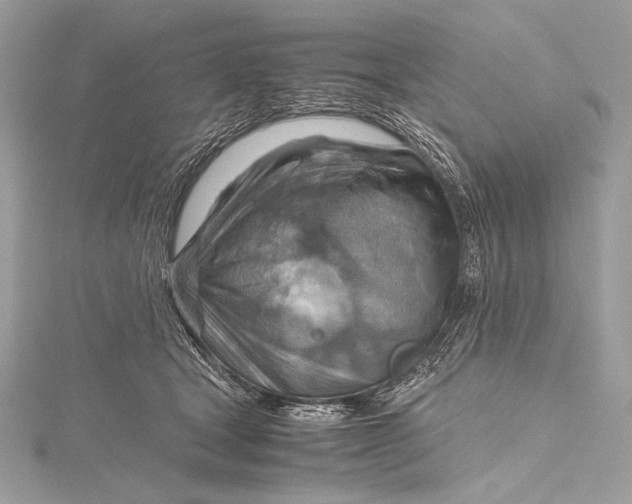 X0000115800465200912041537