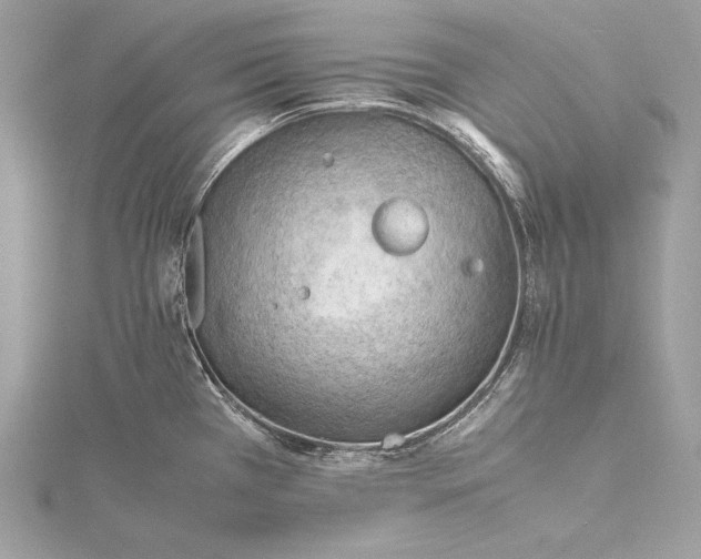 X0000115801385200912041524