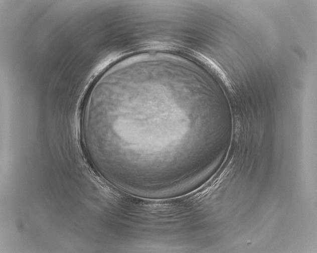 X0000115801419200912041524