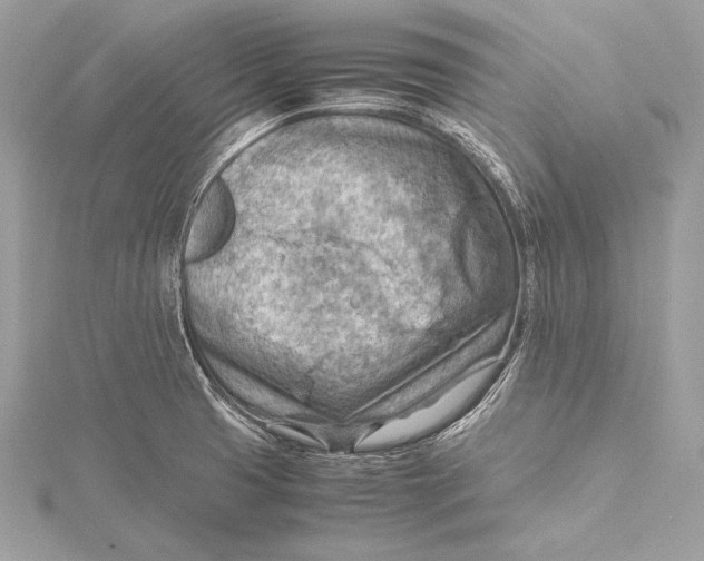 X0000115801425200912041524